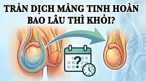 Nam giới bị tràn dịch màng tinh hoàn bao lâu thì khỏi?